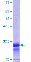 ab112351 analysed on a 12.5% SDS-PAGE gel stained with Coomassie Blue.