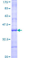 12.5% SDS-PAGE Stained with Coomassie Blue