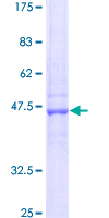 ab158598 on a 12.5% SDS-PAGE stained with Coomassie Blue.