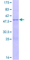 ab158599 on a 12.5% SDS-PAGE stained with Coomassie Blue.