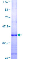 ab158600 on a 12.5% SDS-PAGE stained with Coomassie Blue.