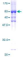 ab158526 on a 12.5% SDS-PAGE stained with Coomassie Blue.