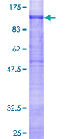 ab158615 on a 12.5% SDS-PAGE stained with Coomassie Blue.