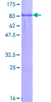 ab160258 on a 12.5% SDS-PAGE stained with Coomassie Blue.