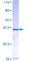 ab160259 on a 12.5% SDS-PAGE stained with Coomassie Blue.
