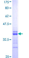 ab158614 on a 12.5% SDS-PAGE stained with Coomassie Blue.