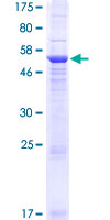 ab165940 on a 12.5% SDS-PAGE stained with Coomassie Blue.