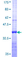 ab160362 on a 12.5% SDS-PAGE stained with Coomassie Blue.