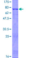 ab158212 on a 12.5% SDS-PAGE stained with Coomassie Blue.