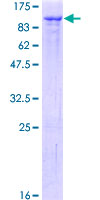 ab161112 on a 12.5% SDS-PAGE stained with Coomassie Blue.