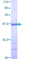 ab161113 on a 12.5% SDS-PAGE stained with Coomassie Blue.