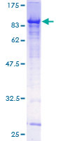 ab161922 on a 12.5% SDS-PAGE stained with Coomassie Blue.