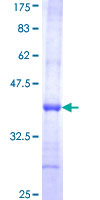 ab162268 on a 12.5% SDS-PAGE stained with Coomassie Blue.