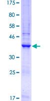 ab160587 on a 12.5% SDS-PAGE stained with Coomassie Blue.