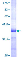 ab158538 on a 12.5% SDS-PAGE stained with Coomassie Blue.