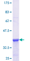 ab158539 on a 12.5% SDS-PAGE stained with Coomassie Blue.