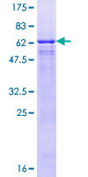 ab158541 on a 12.5% SDS-PAGE stained with Coomassie Blue.