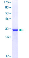 ab158549 on a 12.5% SDS-PAGE stained with Coomassie Blue.