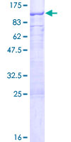ab158551 on a 12.5% SDS-PAGE stained with Coomassie Blue.