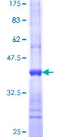 ab158552 on a 12.5% SDS-PAGE stained with Coomassie Blue.