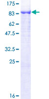 ab160029 on a 12.5% SDS-PAGE stained with Coomassie Blue.