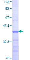 ab160030 on a 12.5% SDS-PAGE stained with Coomassie Blue.