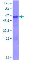 ab165365 on a 12.5% SDS-PAGE stained with Coomassie Blue.