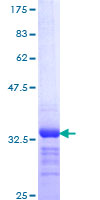 ab158553 on a 12.5% SDS-PAGE stained with Coomassie Blue.