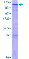 ab160733 on a 12.5% SDS-PAGE stained with Coomassie Blue.