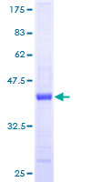 ab162425 on a 12.5% SDS-PAGE stained with Coomassie Blue.