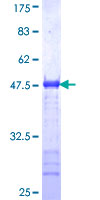 ab153340 on a 12.5% SDS-PAGE stained with Coomassie Blue.