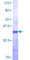 ab153262 on a 12.5% SDS-PAGE stained with Coomassie Blue.