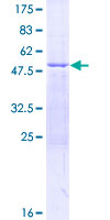 ab160530 on a 12.5% SDS-PAGE stained with Coomassie Blue.