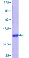 ab160531 on a 12.5% SDS-PAGE stained with Coomassie Blue.