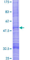 ab162397 on a 12.5% SDS-PAGE stained with Coomassie Blue.