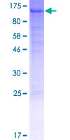 ab153211 on a 12.5% SDS-PAGE stained with Coomassie Blue.