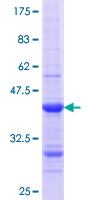 ab160889 on a 12.5% SDS-PAGE stained with Coomassie Blue.