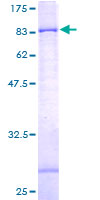 ab160167 on a 12.5% SDS-PAGE stained with Coomassie Blue.