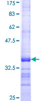 ab160168 on a 12.5% SDS-PAGE stained with Coomassie Blue.
