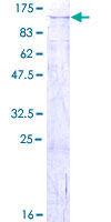 ab153459 on a 12.5% SDS-PAGE stained with Coomassie Blue.