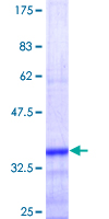 ab153460 on a 12.5% SDS-PAGE stained with Coomassie Blue.