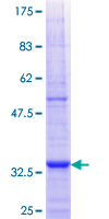 ab165411 on a 12.5% SDS-PAGE stained with Coomassie Blue.