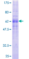 ab158561 on a 12.5% SDS-PAGE stained with Coomassie Blue.