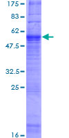 ab158563 on a 12.5% SDS-PAGE stained with Coomassie Blue.