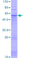 ab158567 on a 12.5% SDS-PAGE stained with Coomassie Blue.