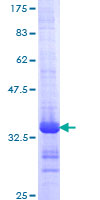 ab165140 on a 12.5% SDS-PAGE stained with Coomassie Blue.