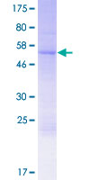 ab162112 on a 12.5% SDS-PAGE stained with Coomassie Blue.