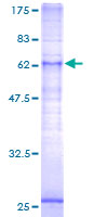 ab163492 on a 12.5% SDS-PAGE stained with Coomassie Blue.