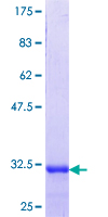 ab163493 on a 12.5% SDS-PAGE stained with Coomassie Blue.