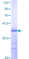 ab163104 on a 12.5% SDS-PAGE stained with Coomassie Blue.